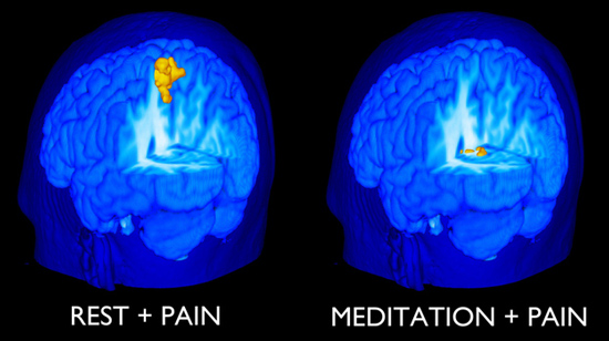 Медитация снижает силу боли.